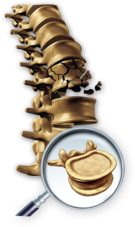 spine